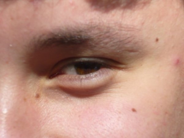 Kliknite pre zobrazenie veľkého obrázka